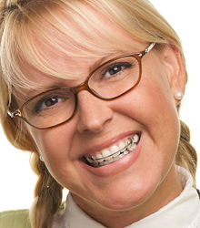 Smiling woman with a retainer